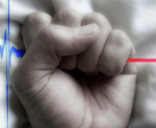 EUTANÁSIA – A FALSA PORTA DA PAZ